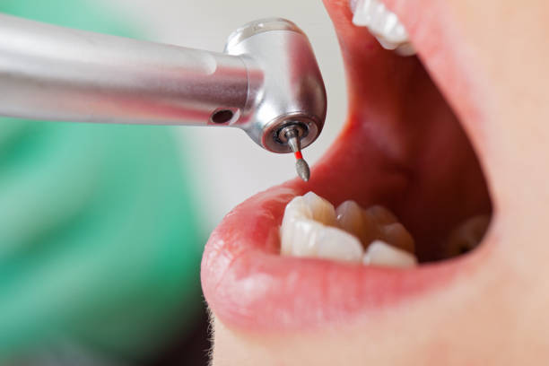 Best After-Hours Dental Trauma Care in Franklin, CA